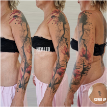 Trash Polka Aortenstenose Magnolie MRT Cover Up Tattoo